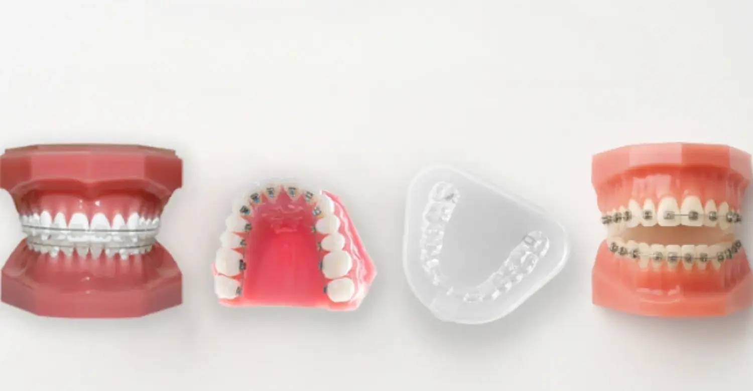 different types of clear aligners 2
